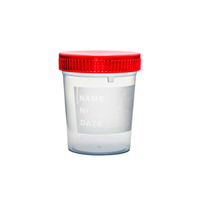 FRASCO ORINA TAPA ROJA 120 ML CJ. X 400 UNDs. — Genérico (ECT97444)